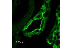 Immunohistochemistry analysis using Rabbit Anti-ENaC Polyclonal Antibody . (SCNN1A antibody  (AA 617-638) (HRP))