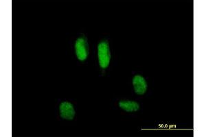 Immunofluorescence of purified MaxPab antibody to USP39 on HeLa cell.