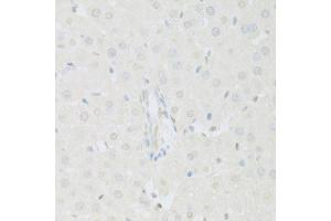Immunohistochemistry of paraffin-embedded rat liver using KAT2A antibody (ABIN5971244) at dilution of 1/100 (40x lens).