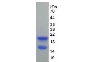 SDS-PAGE analysis of Rat Connexin 40 Protein. (Cx40/GJA5 Protein)