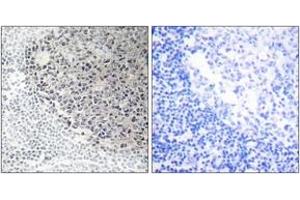 Immunohistochemistry analysis of paraffin-embedded human tonsil tissue, using Collagen IX alpha3 Antibody. (COL9A3 antibody  (AA 321-370))