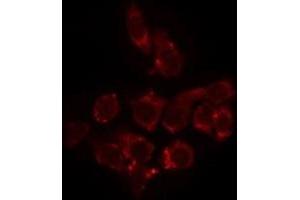 ABIN6275241 staining HeLa by IF/ICC. (SLC25A11 antibody  (Internal Region))