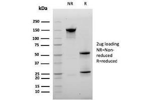 SDS-PAGE Analysis Purified CD20 Mouse Monoclonal Antibody (MS4A1/3410). (CD20 antibody  (AA 213-297))