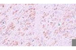 Immunohistochemistry (IHC) image for anti-VENT Homeobox (VENTX) (Middle Region) antibody (ABIN1031159) (VENTX antibody  (Middle Region))