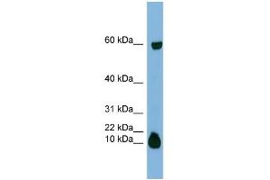 WB Suggested Anti-STATH Antibody Titration:  0. (STATH antibody  (Middle Region))