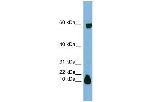 WB Suggested Anti-STATH Antibody Titration:  0.