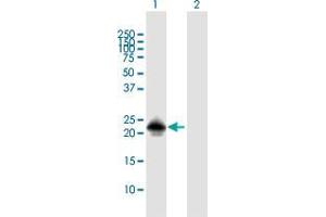 Western Blot analysis of MSRB3 expression in transfected 293T cell line by MSRB3 MaxPab polyclonal antibody.