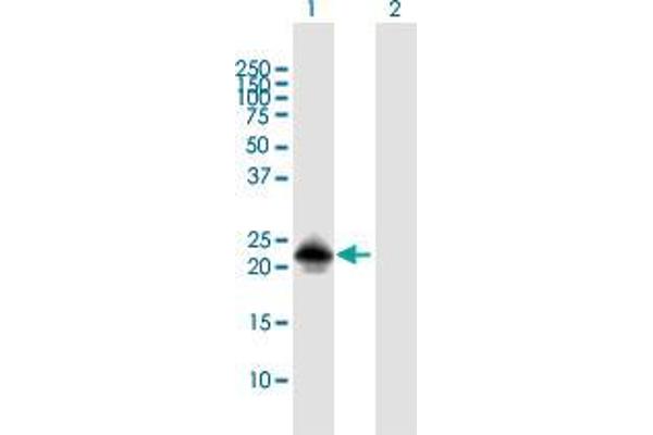 MSRB3 Antikörper  (AA 1-185)