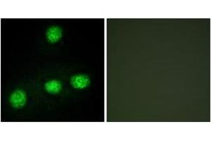 Immunofluorescence analysis of HuvEc cells, using CLK1 Antibody. (CLK1 antibody  (AA 101-150))