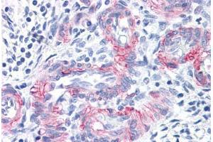 Vessels in Human Uterus: Formalin-Fixed, Paraffin-Embedded (FFPE) (MCAM antibody)