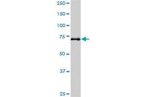 Western Blotting (WB) image for anti-Hedgehog Interacting Protein (HHIP) (AA 21-121) antibody (ABIN466235) (HHIP antibody  (AA 21-121))