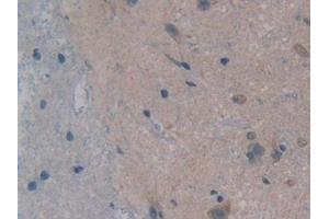 Detection of GR in Rat Spinal cord Tissue using Polyclonal Antibody to Glutathione Reductase (GR) (Glutathione Reductase antibody  (AA 7-246))