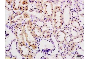 Immunohistochemistry (Paraffin-embedded Sections) (IHC (p)) image for anti-Desmin (DES) (AA 261-360) antibody (ABIN736566)