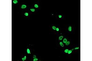 Anti-FMR1 mouse monoclonal antibody (ABIN2455614) immunofluorescent staining of COS7 cells transiently transfected by pCMV6-ENTRY FMR1 (RC222699). (FMR1 antibody  (AA 36-279))