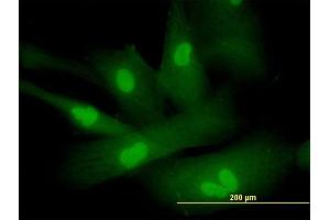 Immunofluorescence of purified MaxPab antibody to SPA17 on Hs 181. (SPA17 antibody  (AA 1-151))
