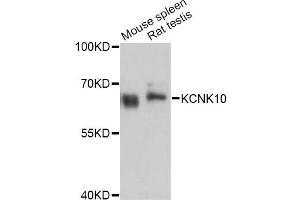Western blot analysis of extracts of various cell lines, using KCNK10 Antibody (ABIN4904134) at 1:3000 dilution. (KCNK10 antibody)