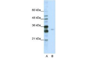 WB Suggested Anti-SFRS1  Antibody Titration: 0.