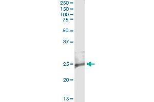 Immunoprecipitation of RASD2 transfected lysate using anti-RASD2 monoclonal antibody and Protein A Magnetic Bead , and immunoblotted with RASD2 MaxPab rabbit polyclonal antibody. (RASD2 antibody  (AA 1-266))