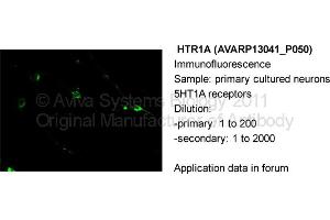 Primary cultured neurons 5HT1A Receptors Dilution:  Primary: 1:200  Secondary: 1:2000 (Serotonin Receptor 1A antibody  (N-Term))