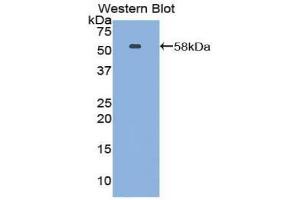 Western blot analysis of the recombinant protein. (Netrin 1 antibody  (AA 313-565))
