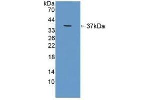 Detection of Recombinant RDX, Human using Polyclonal Antibody to Radixin (RDX) (Radixin antibody  (AA 5-295))