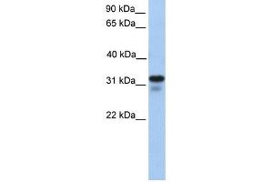 HS3ST6 antibody used at 1 ug/ml to detect target protein. (Heparan Sulfate (Glucosamine) 3-O-Sulfotransferase 6 (HS3ST6) antibody)