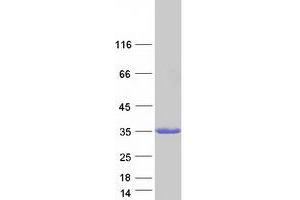 Validation with Western Blot (RAB27A Protein (Transcript Variant 1) (Myc-DYKDDDDK Tag))