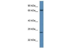 Western Blot showing F11 antibody used at a concentration of 1 ug/ml against Hela Cell Lysate (Factor XI antibody  (C-Term))