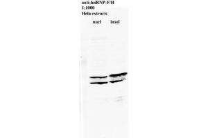 Image no. 2 for anti-Heterogeneous Nuclear Ribonucleoprotein L (HNRNPL) antibody (ABIN108560) (HNRNPL antibody)
