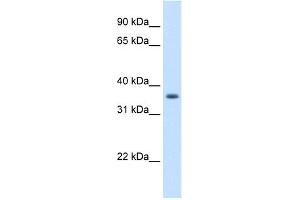 WB Suggested Anti-AKR1B10 Antibody Titration:  1. (AKR1B10 antibody  (N-Term))