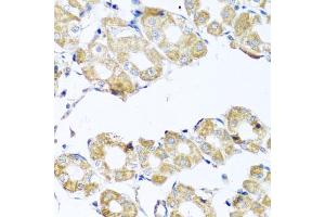 Immunohistochemistry of paraffin-embedded human stomach using COQ7 antibody (ABIN5975182) at dilution of 1/100 (40x lens). (Coq7 antibody)