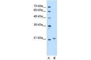 WB Suggested Anti-TCAP Antibody Titration:  5. (TCAP antibody  (Middle Region))