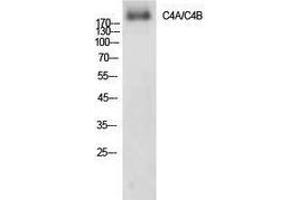 Western Blotting (WB) image for anti-Complement C4A/C4B (Internal Region) antibody (ABIN3178888) (Complement C4A/C4B (Internal Region) antibody)