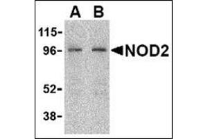 Western blot analysis of NOD2 in HeLa cell lysate with this product at (A) 2 and (B) 4 μg/ml. (NOD2 antibody  (C-Term))