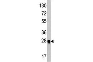 Western blot analysis of ATG12 antibody and recombinant protein. (ATG12 antibody)