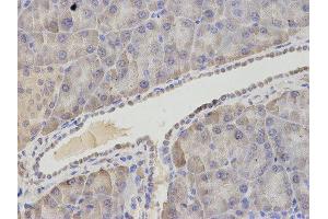 Immunohistochemistry (IHC) image for anti-Asparagine Synthetase (ASNS) antibody (ABIN1876738) (Asparagine Synthetase antibody)