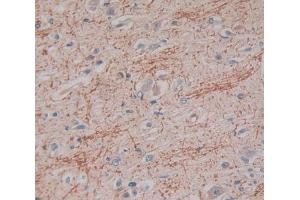 Used in DAB staining on fromalin fixed paraffin- embedded Kidney tissue (IFNA2 antibody  (AA 24-192))