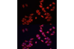 Immunofluorescence analysis of HeLa cells using BNIP3 antibody (ABIN6127502, ABIN6137620, ABIN6137621 and ABIN6221337) at dilution of 1:100. (BNIP3 antibody  (AA 1-164))