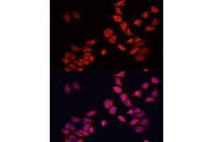 Immunofluorescence analysis of HeLa cells using BNIP3 antibody (ABIN6127502, ABIN6137620, ABIN6137621 and ABIN6221337) at dilution of 1:100. (BNIP3 antibody  (AA 1-164))