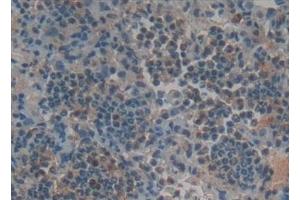 Immunohistochemistry (IHC) image for anti-Tumor Necrosis Factor Receptor Superfamily, Member 11a, NFKB Activator (TNFRSF11A) (AA 31-214) antibody (ABIN7434632)