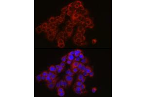 Immunofluorescence analysis of MCF7 cells using TYK2 Rabbit pAb (ABIN3022987, ABIN3022988, ABIN3022989 and ABIN6219333) at dilution of 1:150 (40x lens). (TYK2 antibody  (AA 750-850))