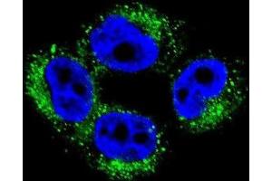 Immunofluorescence (IF) image for anti-Adaptor-Related Protein Complex 1, mu 1 Subunit (AP1M1) antibody (ABIN2996504) (AP1M1 antibody)