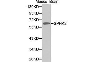 Western Blotting (WB) image for anti-Sphingosine Kinase 2 (SPHK2) (AA 1-165) antibody (ABIN1682869) (SPHK2 antibody  (AA 1-165))