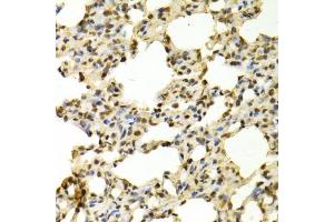 Immunohistochemistry of paraffin-embedded rat lung using PADI4 antibody (ABIN5970978) at dilution of 1/100 (40x lens). (PAD4 antibody)
