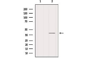 Western Blotting (WB) image for anti-Nuclear Factor of kappa Light Polypeptide Gene Enhancer in B-Cells Inhibitor, alpha (NFKBIA) (N-Term) antibody (ABIN6262504)