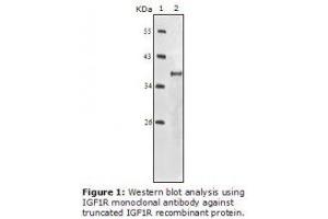 Image no. 2 for anti-Insulin-Like Growth Factor 1 Receptor (IGF1R) antibody (ABIN232138) (IGF1R antibody)