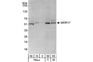 anti-WD Repeat Domain 12 (WDR12) (AA 300-350) antibody