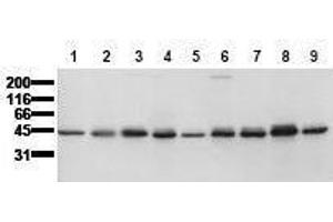 Western Blotting (WB) image for anti-Casein Kinase 1, epsilon (CSNK1E) (AA 355-380) antibody (ABIN126752) (CK1 epsilon antibody  (AA 355-380))