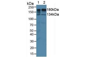 Figure. (EGFR antibody  (AA 888-1210))