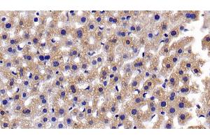 Detection of CASP3 in Mouse Liver Tissue using Polyclonal Antibody to Caspase 3 (CASP3) (Caspase 3 antibody  (AA 29-175))